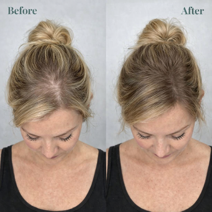 Rosemarien™  Hair Growth Shampoo