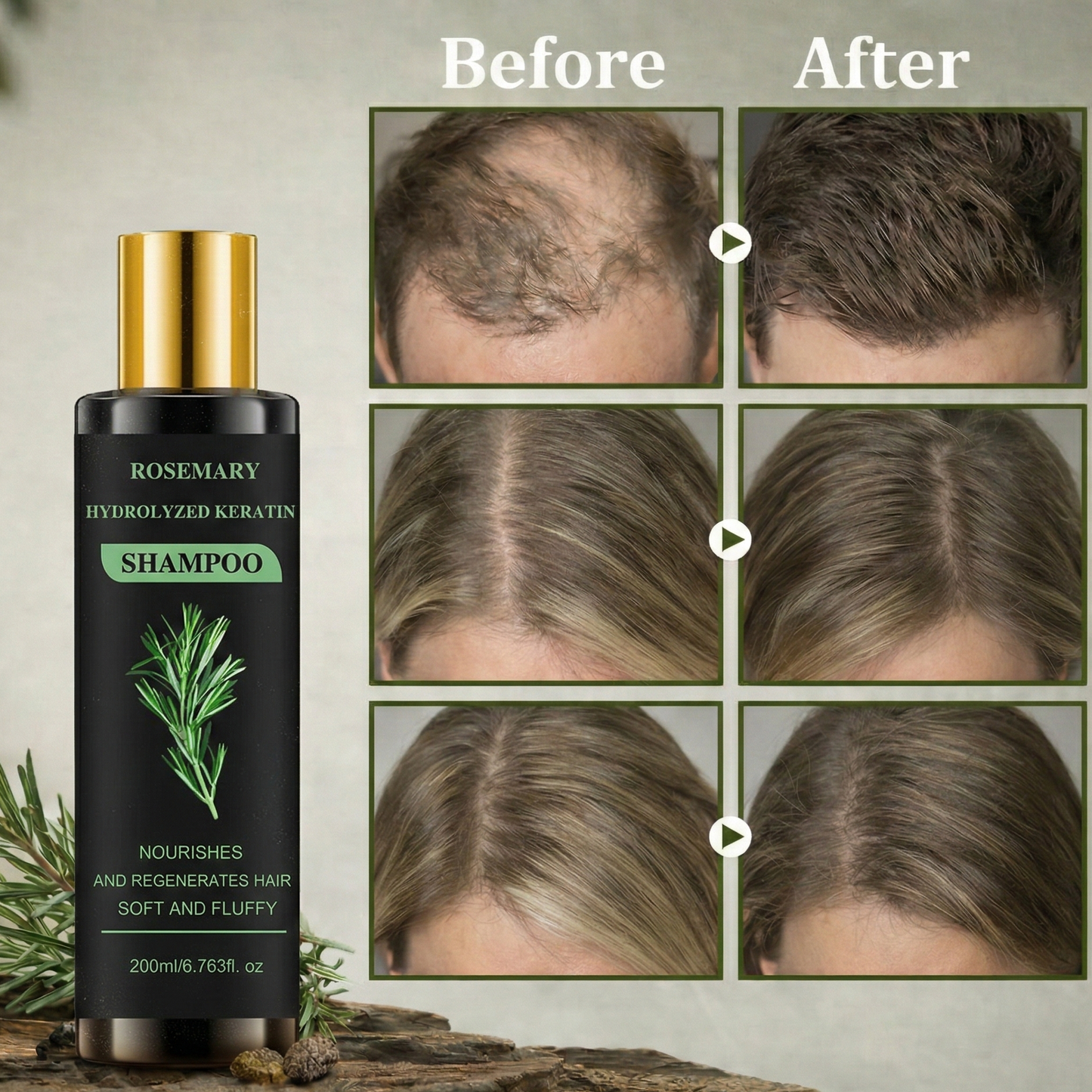 Rosemarien™  Hair Growth Shampoo