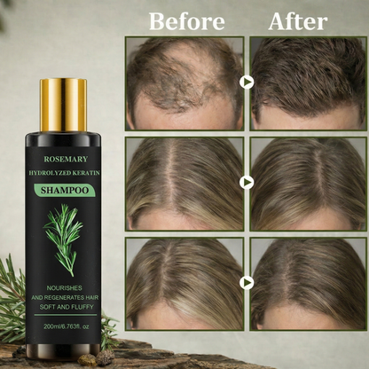 Rosemarien™  Hair Growth Shampoo